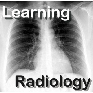 LearningRadiology Video Podcasts-logo