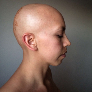 The Bald Project-logo