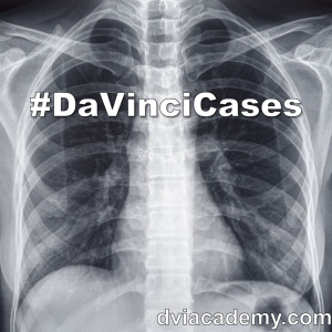 #DaVinciCases-logo