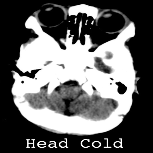 Head Cold Listen to All Episodes Science & Technology News