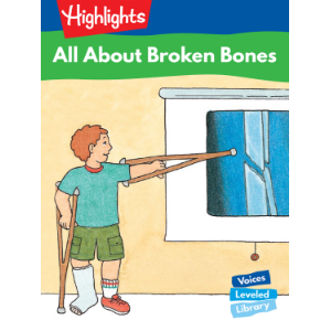 All About Broken Bones
