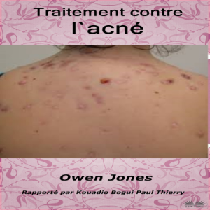 Traitement contre l`acné