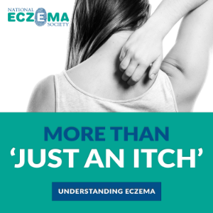More Than "Just An Itch": Understanding Eczema-logo