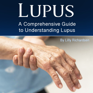 Lupus