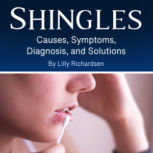 Shingles