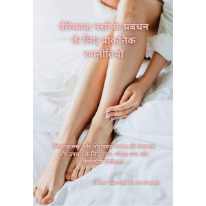 वैरिकाज़ नसों के प्रबंधन के लिए प्राकृतिक रणनीतियाँ